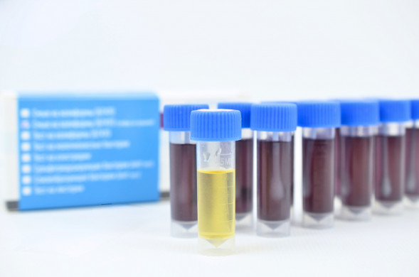 PSKBBGKP-12 Петритест смыв на колиформные бактерии (БГКП), 12 тестов